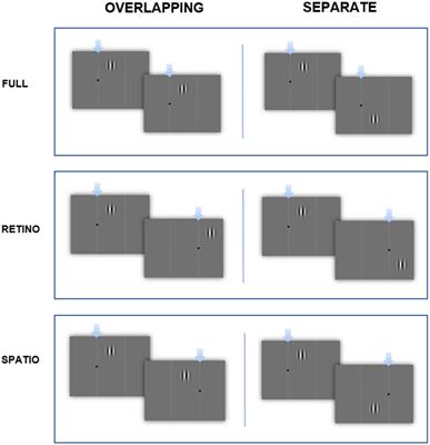 Time-Order Errors in Duration Judgment Are Independent of Spatial Positioning